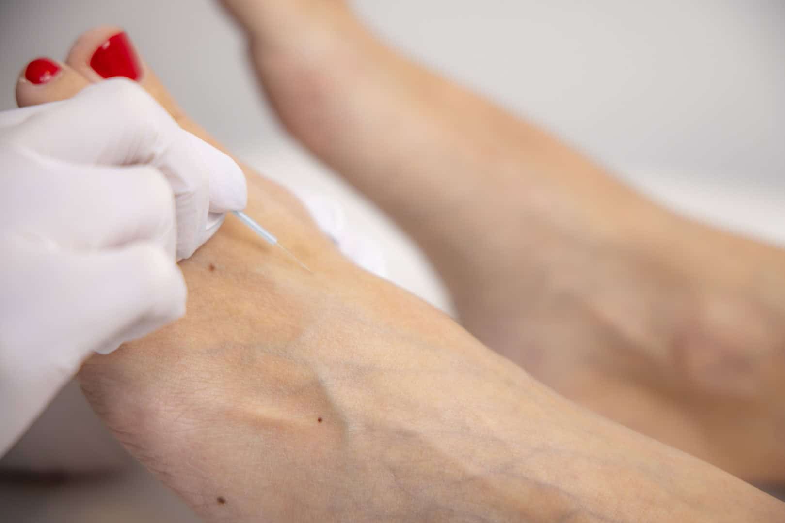 Schmerzfreie gynäkologische Untersuchung bei Frauenärztin Dr. Daniela Gold in Graz.
